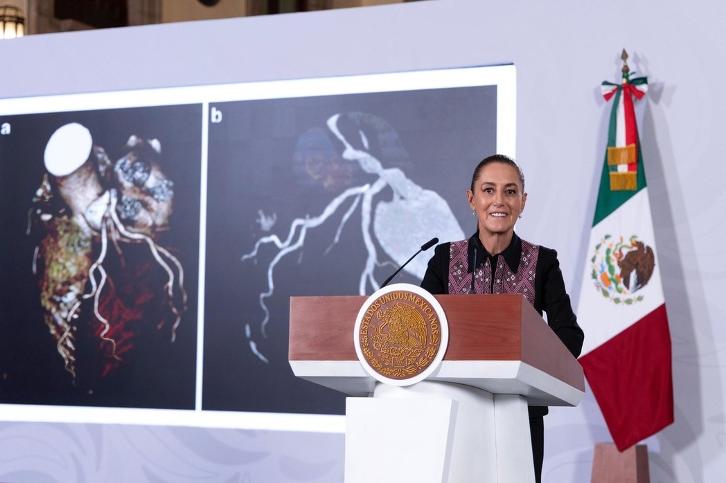 IMSS adquirió 42 tomógrafos de ultra alta gama con Inteligencia Artificial; presidenta Sheinbaum destaca “salto tecnológico” histórico